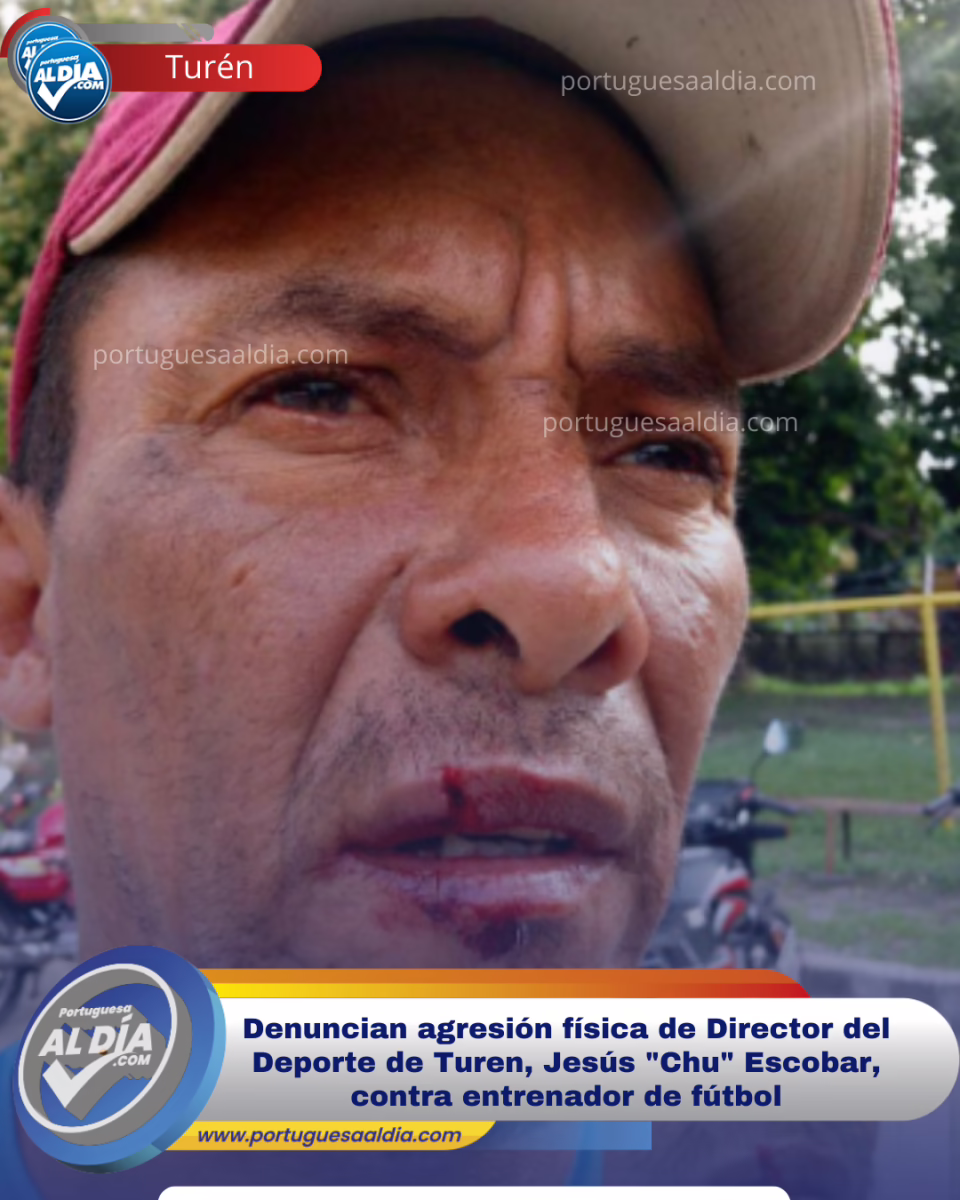 Acusan a Jesús "Chu" Escobar, Director del Deporte de Turén, de agredir físicamente a un entrenador de fútbol – portuguesaaldia.com