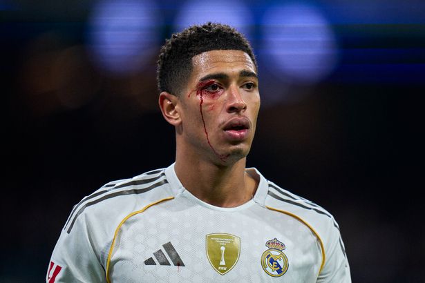 MADRID, ESPAÑA - 7 DE DICIEMBRE: Jude Bellingham del Real Madrid CF mira con un corte sangrante en la ceja durante el partido de LaLiga EA Sports entre el Real Madrid CF y el RC Celta de Vigo en el Estadio Santiago Bernabeu el 7 de diciembre de 2025 en Madrid, España. (Foto de Diego Souto/Getty Images)
